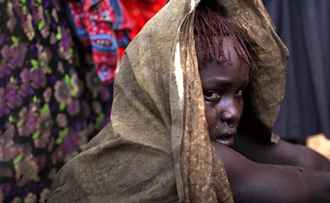 Sünnet edilen 10 yaşındaki kız çocuğu kan kaybından öldü! - Resim: 1