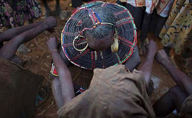 Sünnet edilen 10 yaşındaki kız çocuğu kan kaybından öldü! - Resim: 2