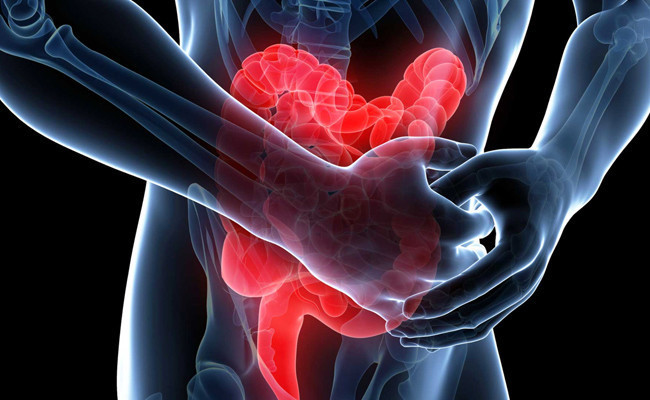 Sindirim sistemine iyi gelen 6 mucizevi besin! - Resim: 1