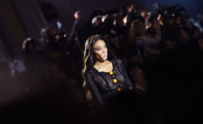 Hastalığı ilham kaynağı oldu! Sıradışı modelin dikkat çeken itirafları - Resim: 1