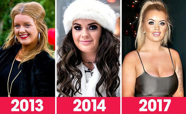 Loto'dan 8 milyon TL kazandı parayı estetiğe yatırdı! Şimdi bambaşka biri! - Resim: 1