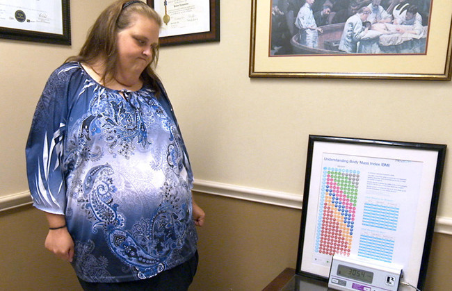 Tüp mide gastrik bypass ve kelepçe ameliyatı nedir hangisi iyi? - Resim: 4