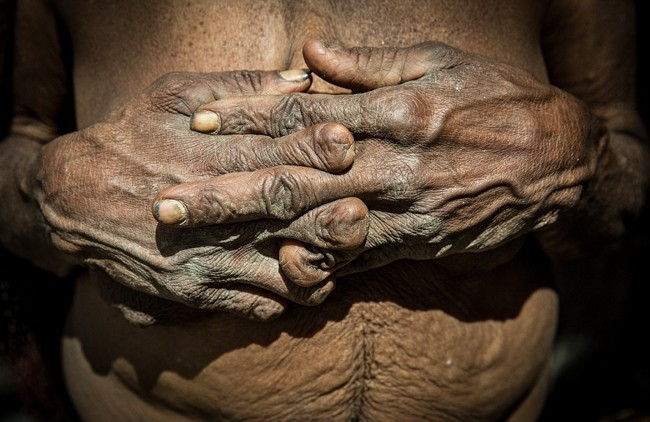 Böyle korkunç gelenek görülmedi! Eşler ölünce parmaklar kesiliyor - Resim: 1
