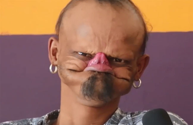 Diliyle alnını yalayan adam inanılmaz ama gerçek... - Resim: 3