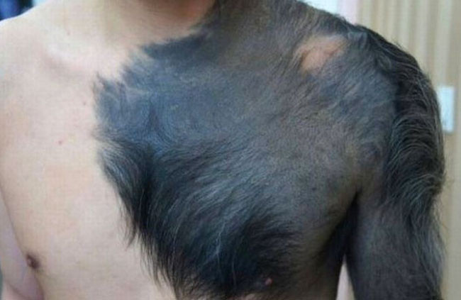 Vücudu görenleri dehşete düşürdü - Resim: 2