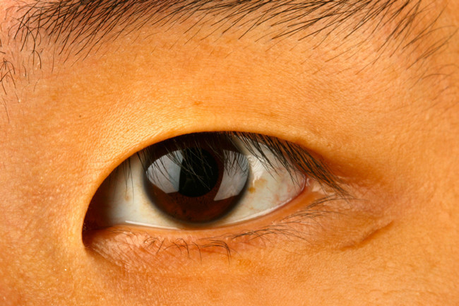 Gözünden ne çıktığını duyunca hayret edeceksiniz - Resim: 1