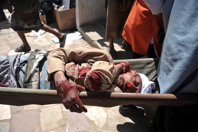 Bunlar da dünyanın bugün tıkladıkları - Resim: 3