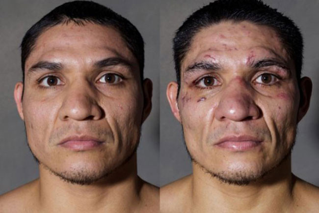 Dayaktan ne hale geldiler - Resim: 1