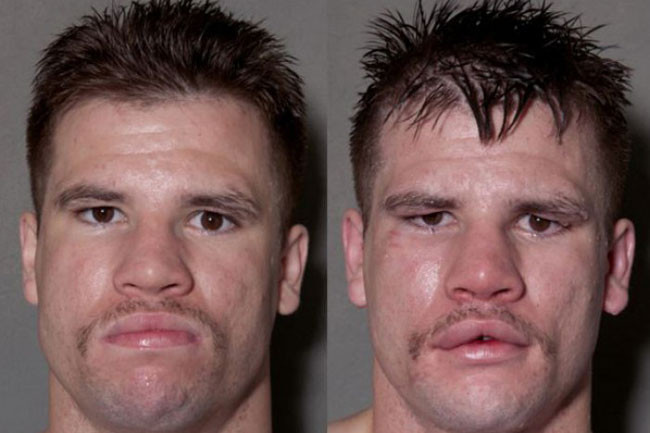 Dayaktan ne hale geldiler - Resim: 2