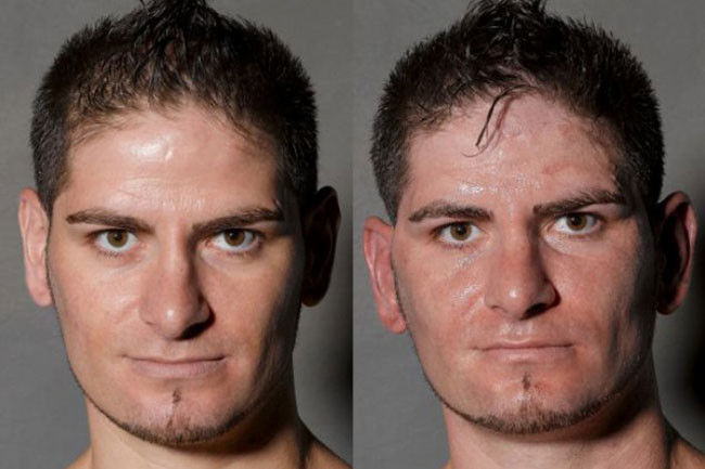 Dayaktan ne hale geldiler - Resim: 3