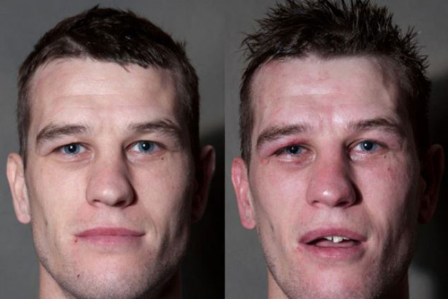 Dayaktan ne hale geldiler - Resim: 4