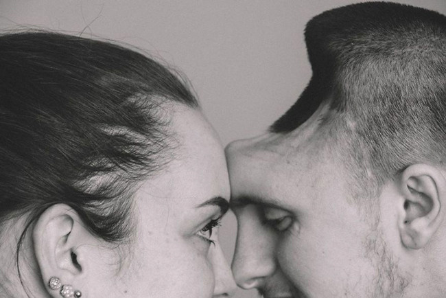 İçtiği şey yüzünden kafasının yarısını kaybetti görenler inanamıyor - Resim: 1