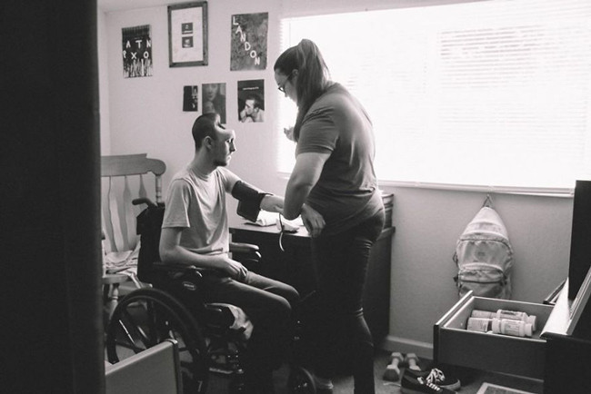 İçtiği şey yüzünden kafasının yarısını kaybetti görenler inanamıyor - Resim: 2