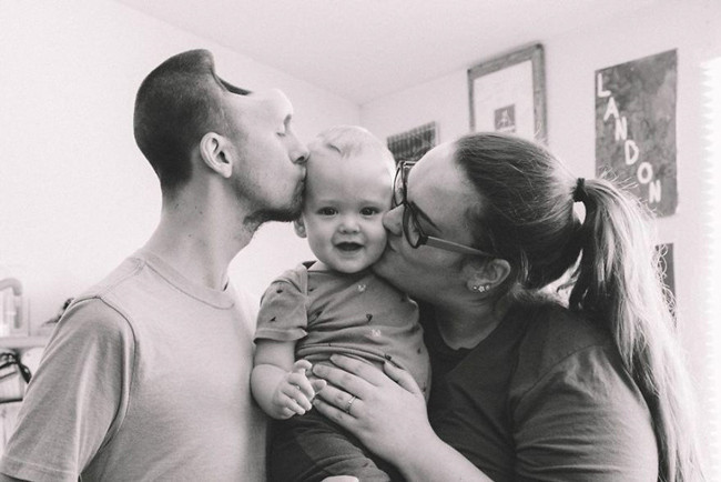 İçtiği şey yüzünden kafasının yarısını kaybetti görenler inanamıyor - Resim: 4