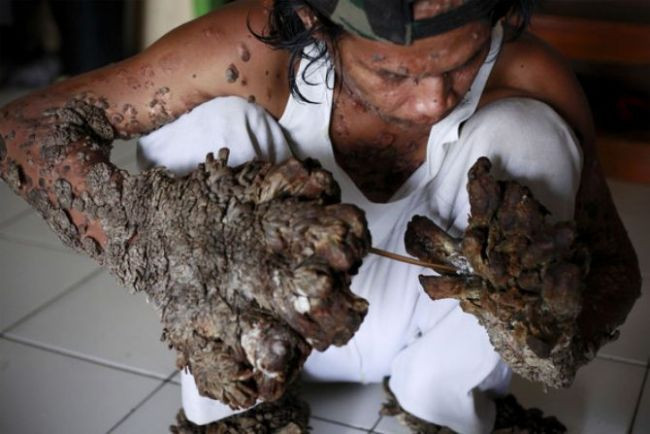 Ağaç adamın son hali - Resim: 4