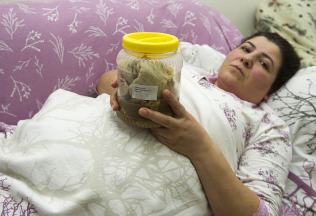 Karnından çıktı tam 1,8 kilo! Yeni bir gelişme yaşandı - Resim: 1