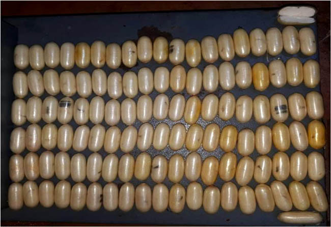 Havalimanında şoke eden görüntü! Kadın yolcunun... - Resim: 4