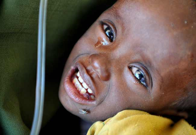 Somali'den yürek burkan tablo - Resim: 3