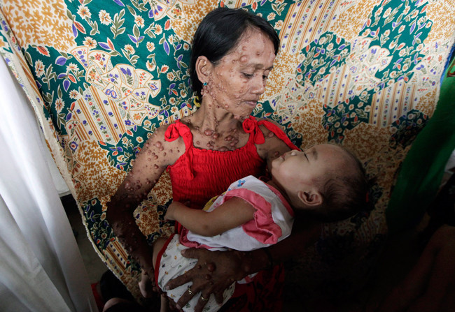 Ona biraz daha yakından bakın - Resim: 1