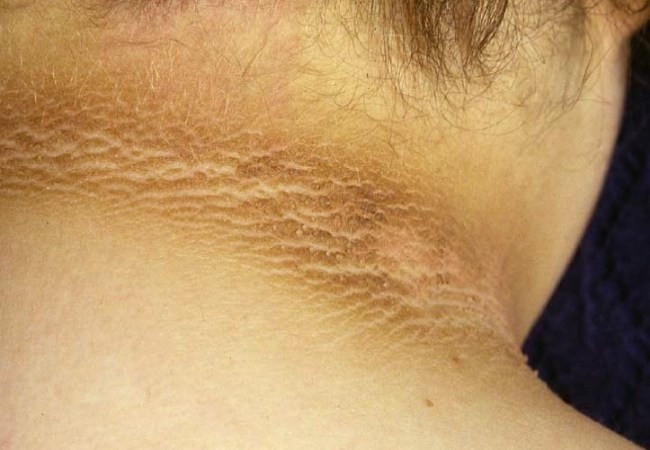 Annesi kir sandı ama hastalık çıktı! - Resim: 1