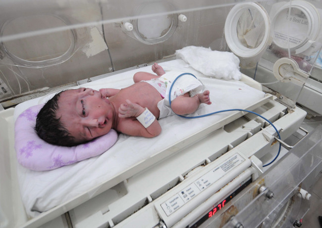 Dünyayı şok eden iki yüzlü bebek - Resim: 2