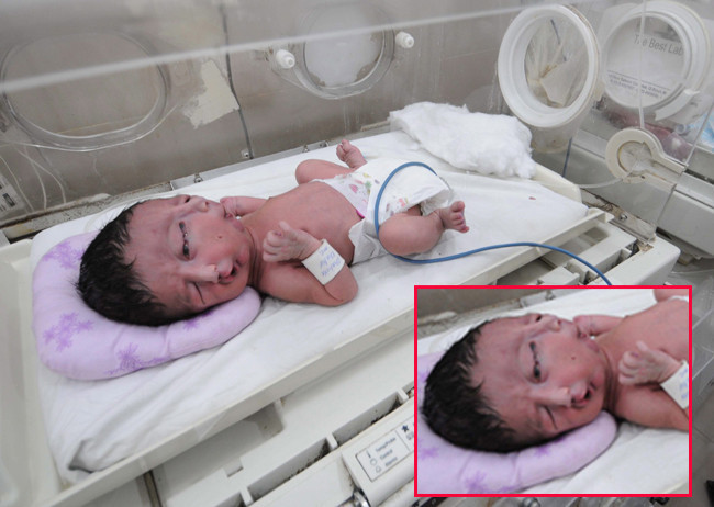 Dünyayı şok eden iki yüzlü bebek - Resim: 3