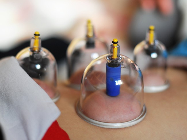 Hacamat gerçekten faydalı mı? - Resim: 2