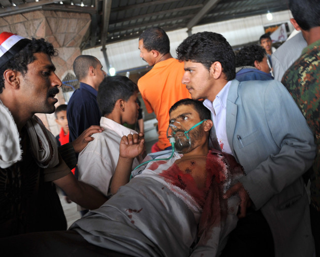 Dünya bir gününü de böyle geçirdi - Resim: 3