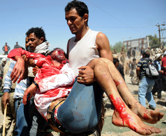 Bunlar da dünyanın bugün tıkladıkları - Resim: 1