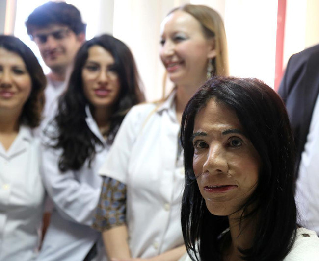 Yüz naklinde çığır açacak ameliyat - Resim: 3