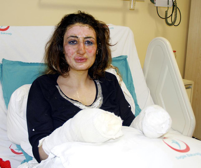 Bebeği ile birlikte yanan öğretmen konuştu - Resim: 2