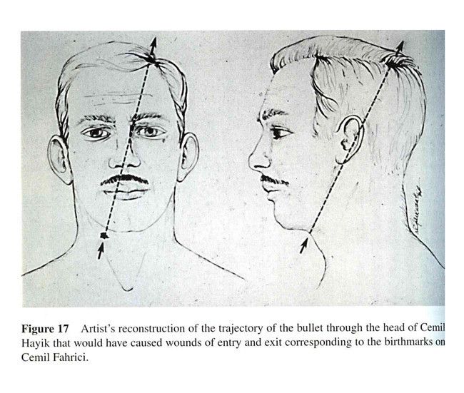 2 yaşında öldükten sonra tekrar geldim dedi tüyler ürperten olay - Resim: 3