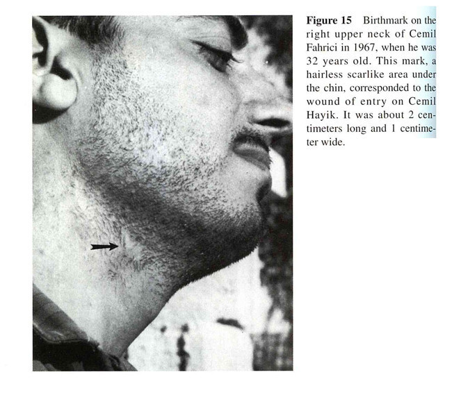 2 yaşında öldükten sonra tekrar geldim dedi tüyler ürperten olay - Resim: 4