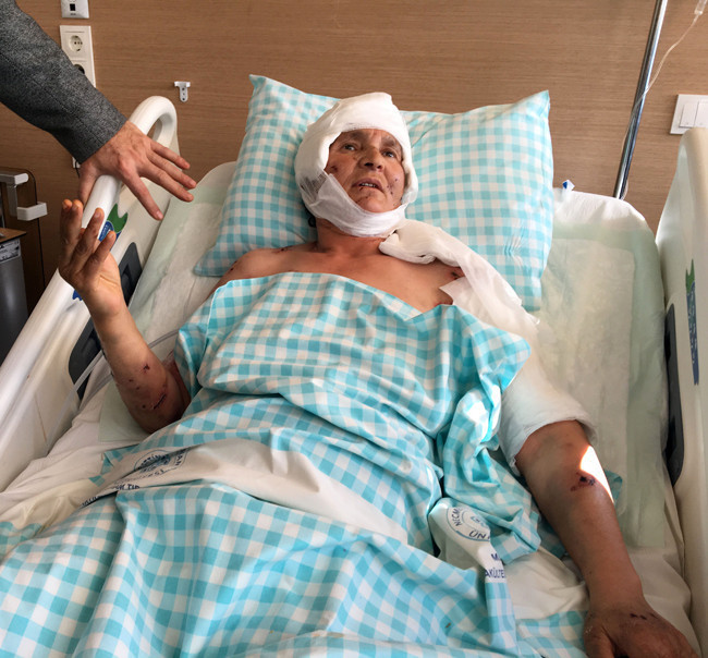 9 köpek saldırdı kafasındaki saç derisinin üçte ikisi yok - Resim: 1