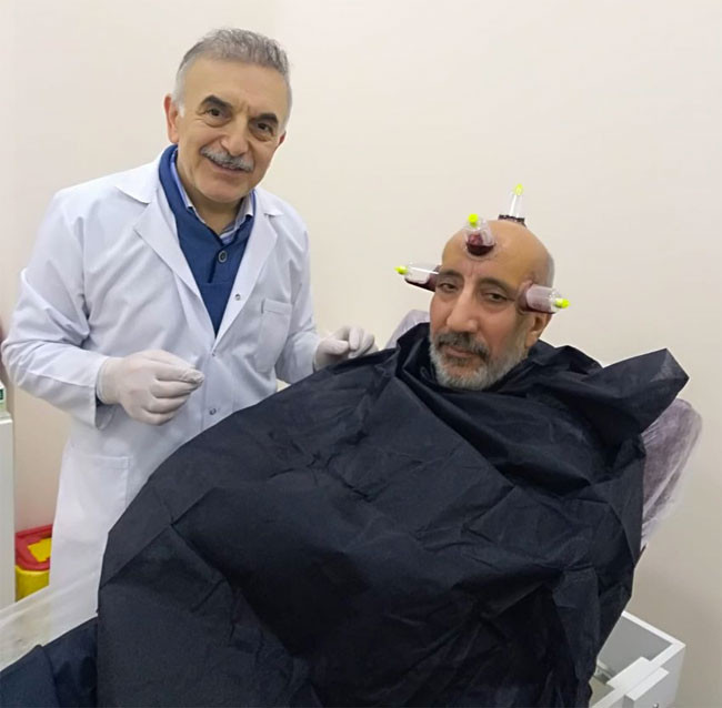 Abdurrahman Dilipak kendine ne yapmış öyle göz için hacamat yapılır mı? - Resim: 2