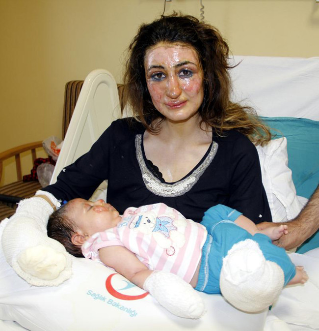 Bebeği ile birlikte yanan öğretmen konuştu - Resim: 1