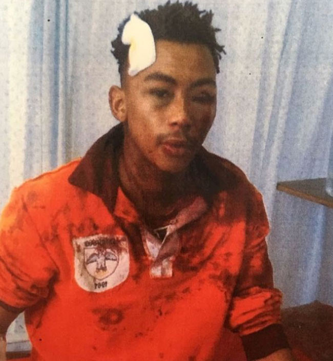 Arabasıyla kaçırdıkları kıza 4 kişi tecavüz etti sonrası da korkunç - Resim: 3