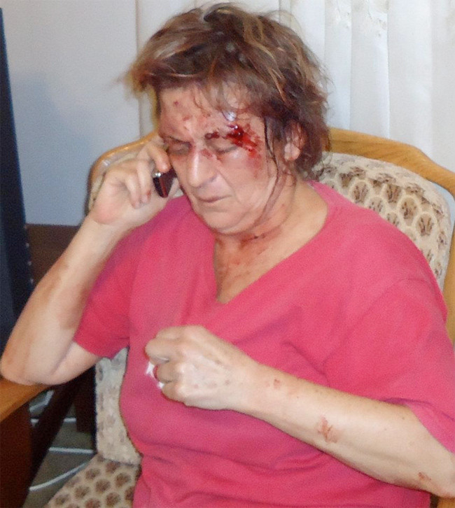 İşte Beşar Esad'a karşı olmanın bedeli! - Resim: 3