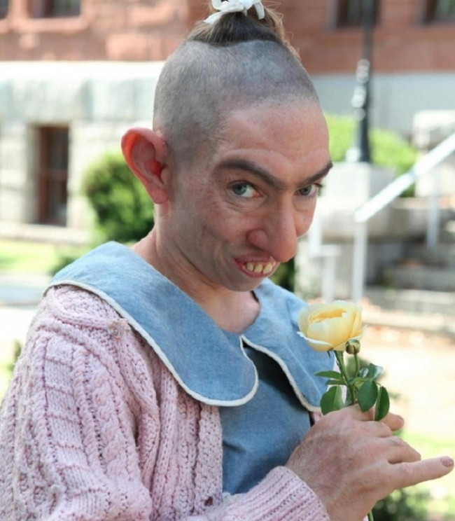 Çok ünlü bir oyuncuydu bu hale geldi kimse tanımadı - Resim: 2