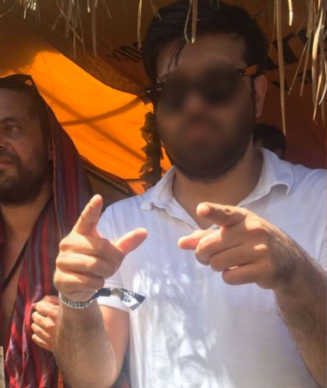 Stajer avukat sevgili dehşetini anlattı! Suratımı ısırdı kafa attı yumrukladı - Resim: 4