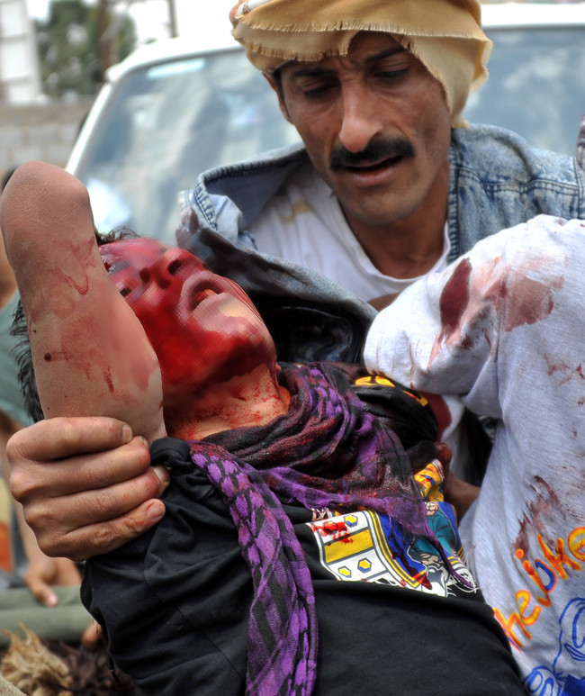 Dünyayı sarsan en iddialı fotoğraflar - Resim: 1