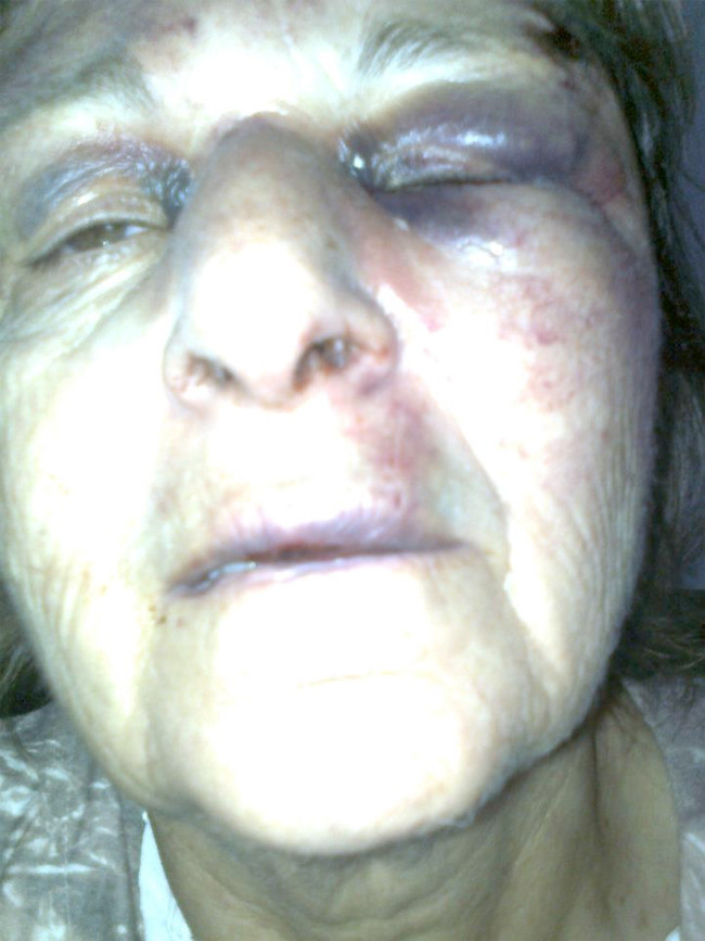 İşte Beşar Esad'a karşı olmanın bedeli! - Resim: 1