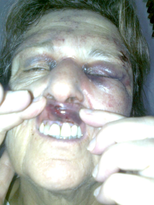 İşte Beşar Esad'a karşı olmanın bedeli! - Resim: 2