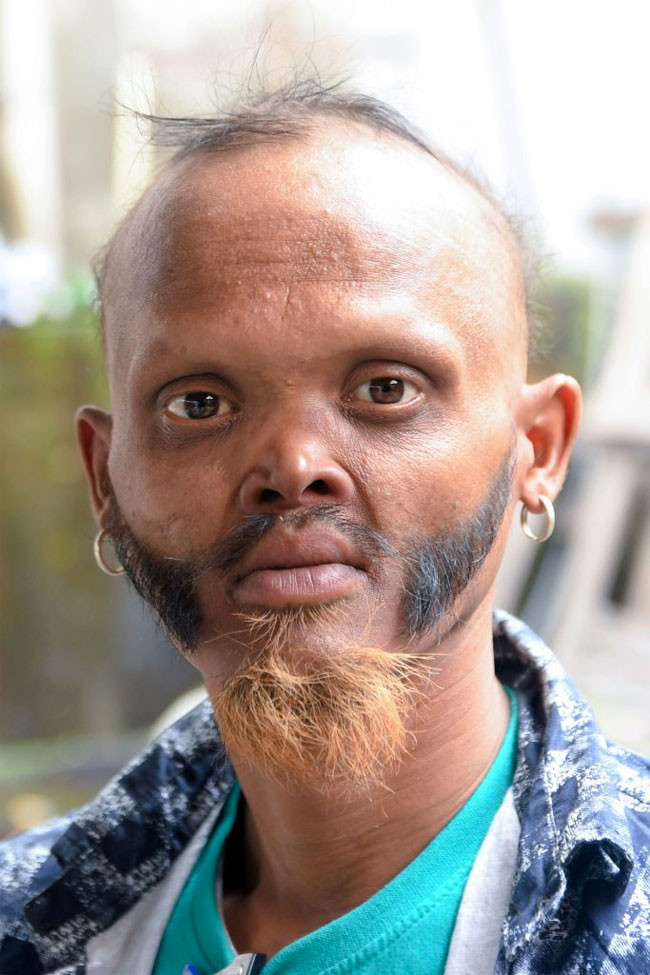 Diliyle alnını yalayan adam inanılmaz ama gerçek... - Resim: 4