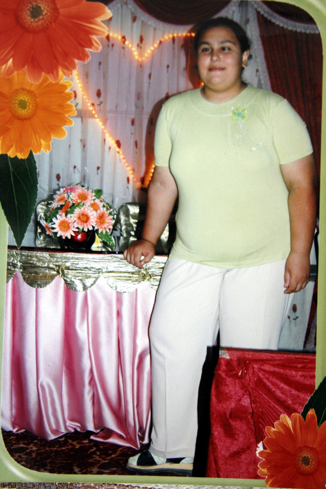 Zayıflamak isterken canından oldu - Resim: 3