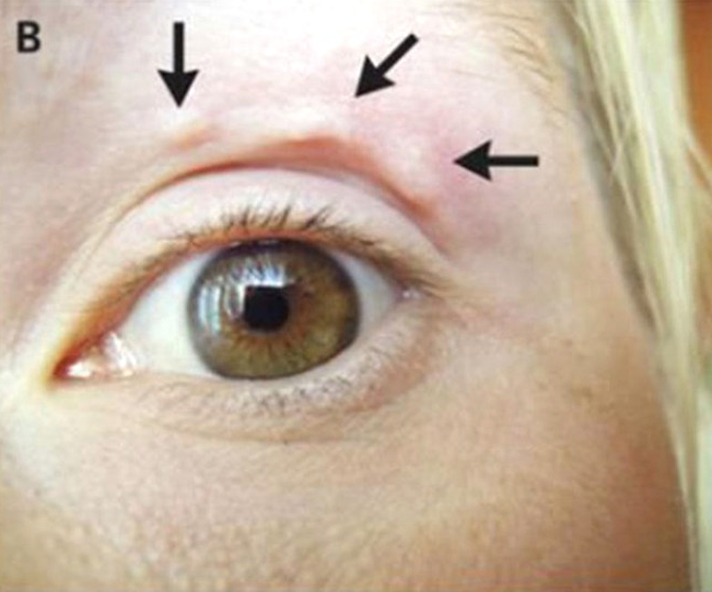 Yüzü birden bu hale gelmeye başladı içinden çıkanlar ise inanılmaz - Resim: 2