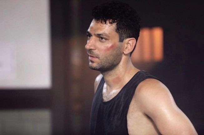 Murat Yıldırım talihsiz bir kaza geçirdi Show TV Ramo dizisinin setini durdurmadı - Resim: 3