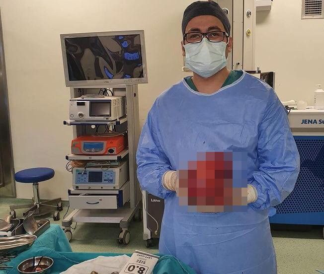 Kanından çıktı! Doktorlar da şoke oldu! Futbol topu büyüklüğünde... - Resim: 1