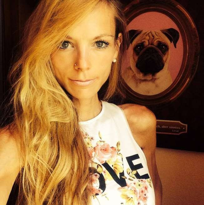 Dünyaca ünlü Alman modelin şok ölümü! Zayıflama uğruna... - Resim: 4