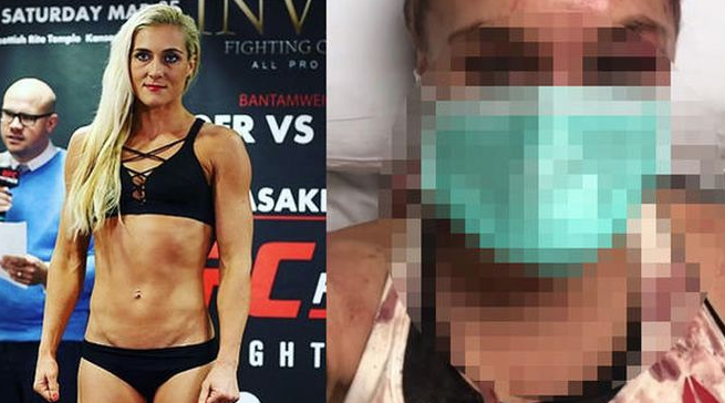 Yana Foxy Kunitskaya'nın burnu kırıldı tanınmaz hale geldi - Resim: 1